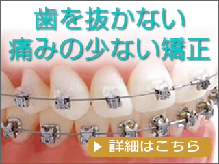 歯を抜かない矯正歯科